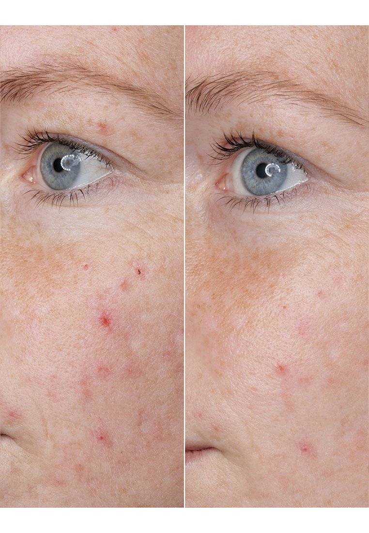 BABOR BABOR HYALURONIC ACID AMPOULE - Serum Kostenloser Versand